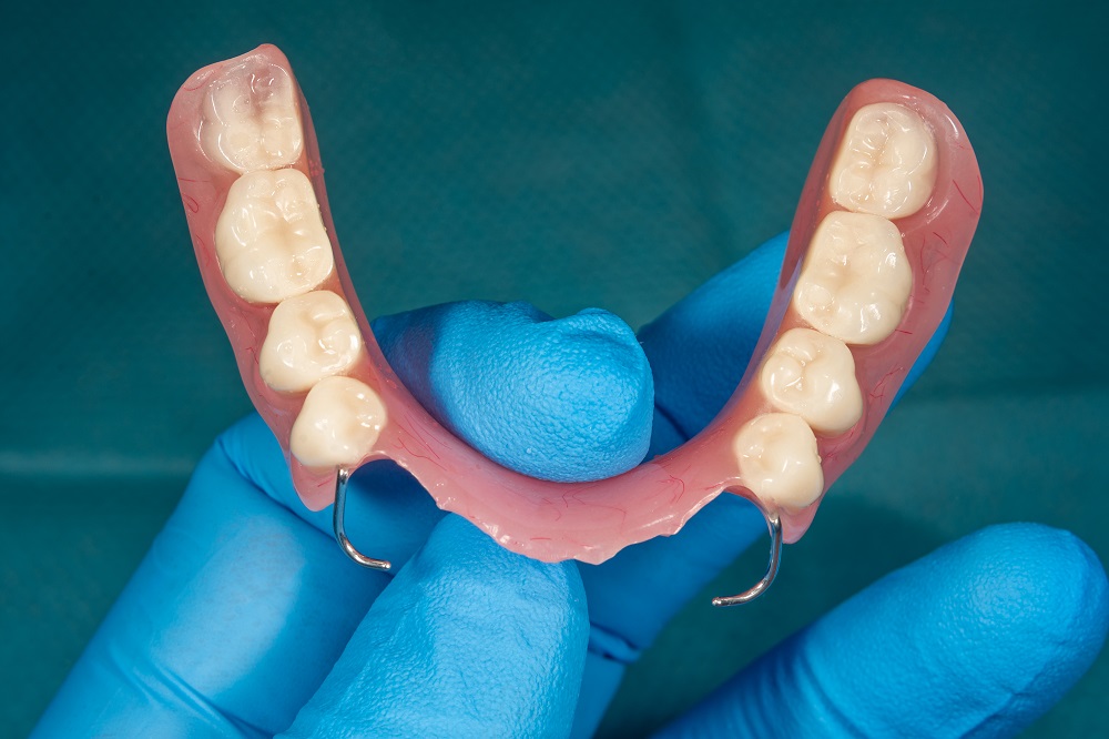 Dentist holding partial dentures at Sunrise Dental Clinic in Gig Harbor WA