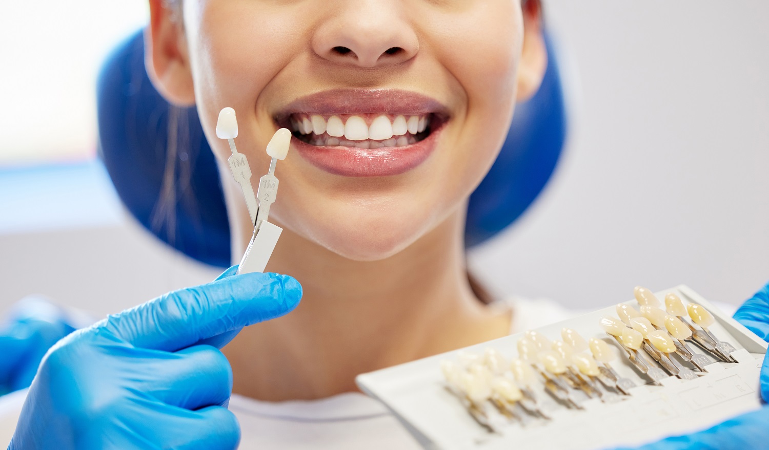 Dental veneers options at Sunrise Dental Clinic in Gig Harbor WA